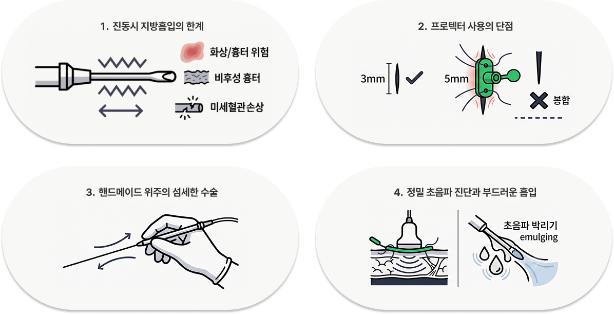 1. 진동시 지방흡입의 한계 2. 프로텍터 사용의 단점 3. 핸드메이드 위주의 섬세한 수술 4. 정밀 초음파 진단과 부드러운 흡입