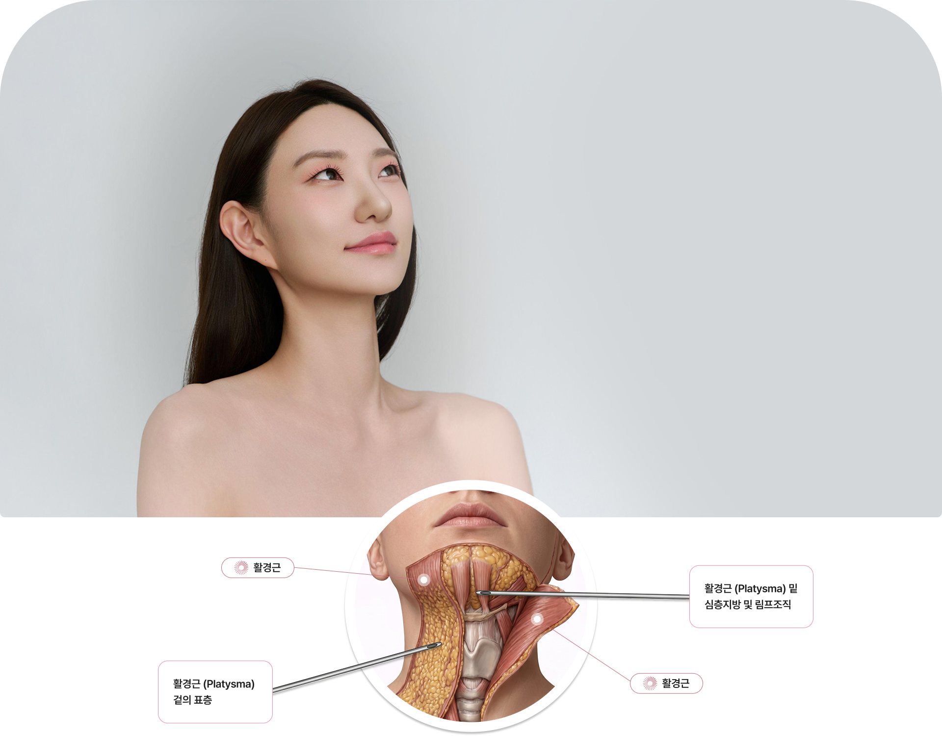넓은 목근 (Platysma) 겉의 표층 · 넓은 목근 (Platysma) 밑 심층지방 및 림프조직
