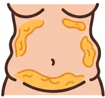 고르지 못한 흡입